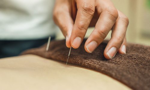 Acupuncture needles for woman's body