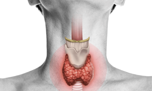 Thyroid